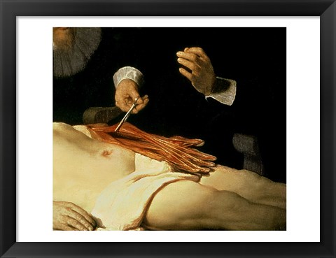 Framed Anatomy Lesson of Dr. Nicolaes Tulp, 1632 (arm detail) Print