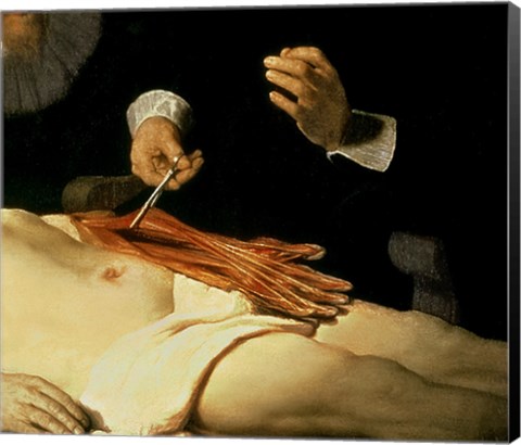 Framed Anatomy Lesson of Dr. Nicolaes Tulp, 1632 (arm detail) Print