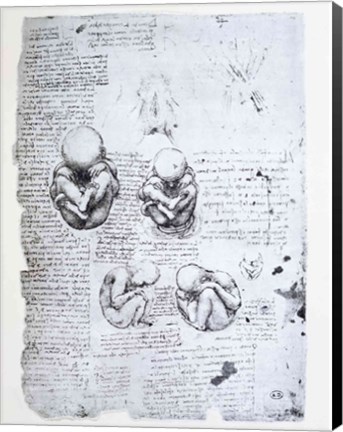 Framed Five Views of a Fetus in the Womb Print