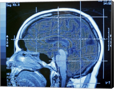 Framed Close-up of an MRI scan of the human brain Print