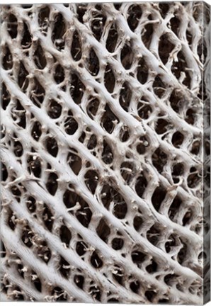 Framed Lattice pattern in Giant Loebelia, Bale Mountains, Ethiopia Print