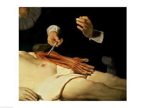 Framed Anatomy Lesson of Dr. Nicolaes Tulp, 1632 (arm detail) Print