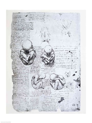 Framed Five Views of a Fetus in the Womb Print