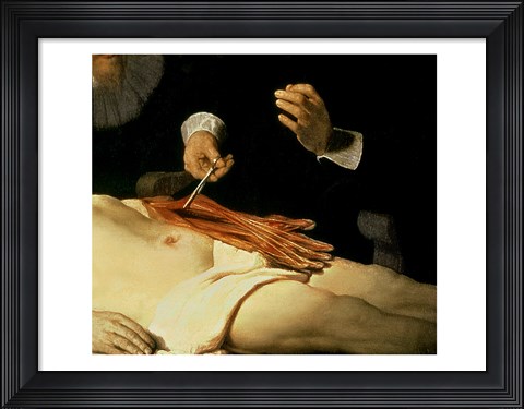 Framed Anatomy Lesson of Dr. Nicolaes Tulp, 1632 (arm detail) Print