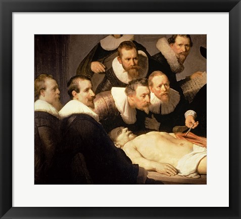 Framed Anatomy Lesson of Dr. Nicolaes Tulp, 1632 (detail) Print