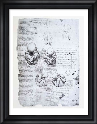 Framed Five Views of a Fetus in the Womb Print