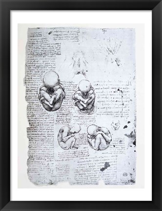 Framed Five Views of a Fetus in the Womb Print