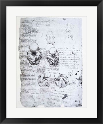 Framed Five Views of a Fetus in the Womb Print