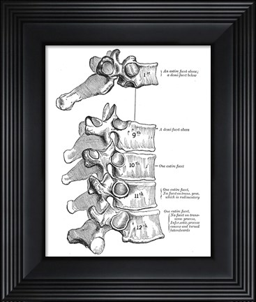 Framed Vertebrae Diagram Print