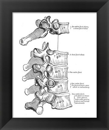 Framed Vertebrae Diagram Print