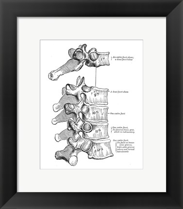 Framed Vertebrae Diagram Print