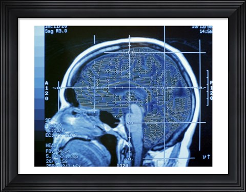 Framed Close-up of an MRI scan of the human brain Print