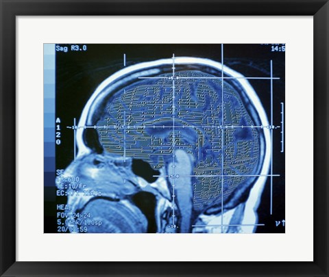 Framed Close-up of an MRI scan of the human brain Print