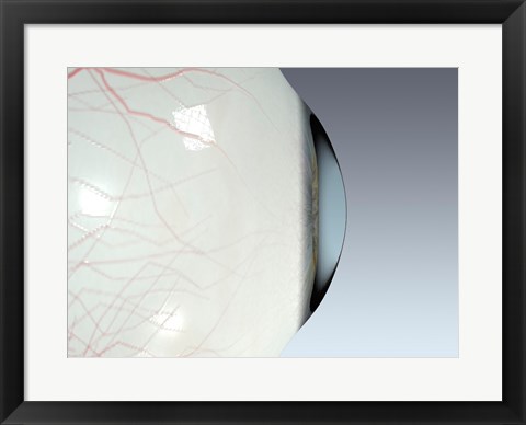 Framed Close-up of the human eyeball side view Print