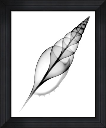 Framed Tibia, Martin&#39;s X-Ray Print