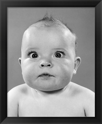 Framed 1950s Close-Up Of Baby Cross-Eyed Print